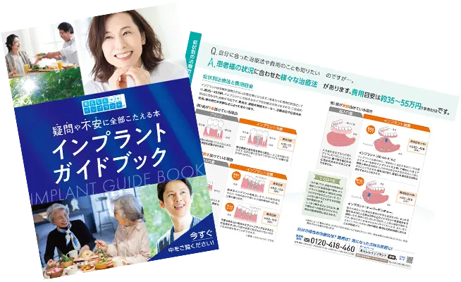 インプラントガイドブックの画像