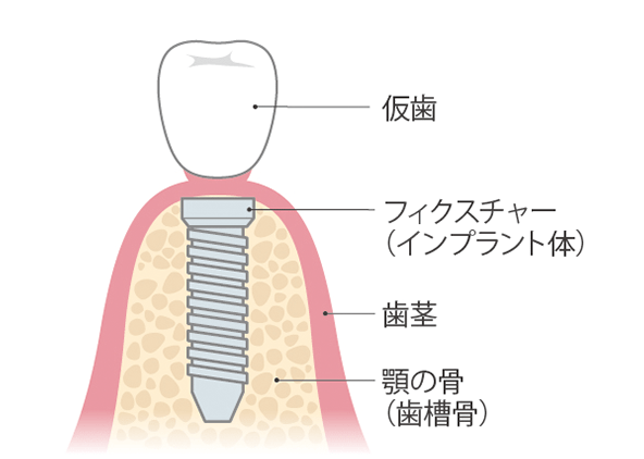 治療期間