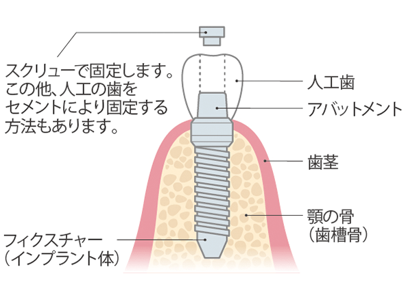装着